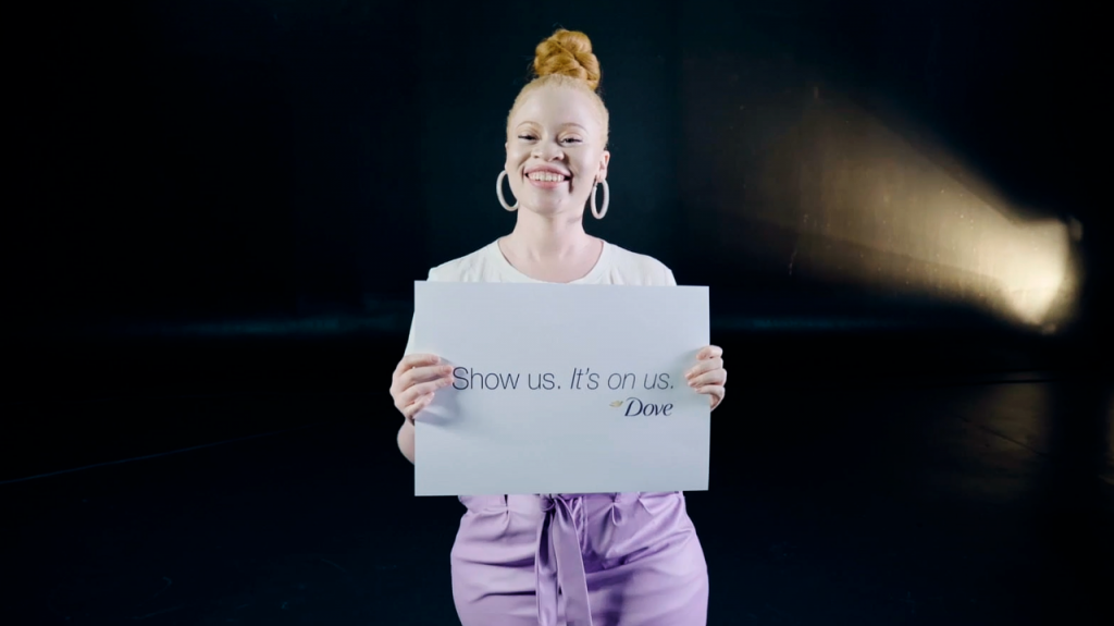 Dove inclusive model holding bord with Show us. It's on us.